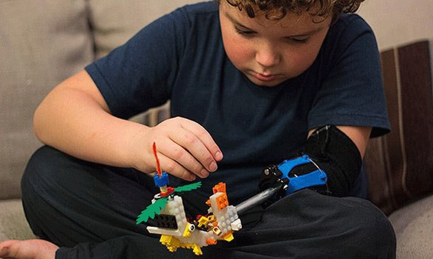 Bambino di nove anni costruisce una protesi con i Lego