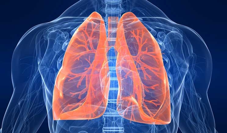 Da Napoli un kit per la diagnosi del tumore al polmone