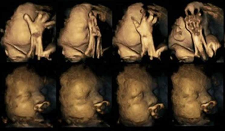 Fumo in gravidanza, fotografati in 4d gli effetti sul feto