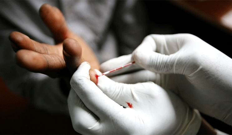 Aids: in arrivo un test â€œfai-da-teâ€