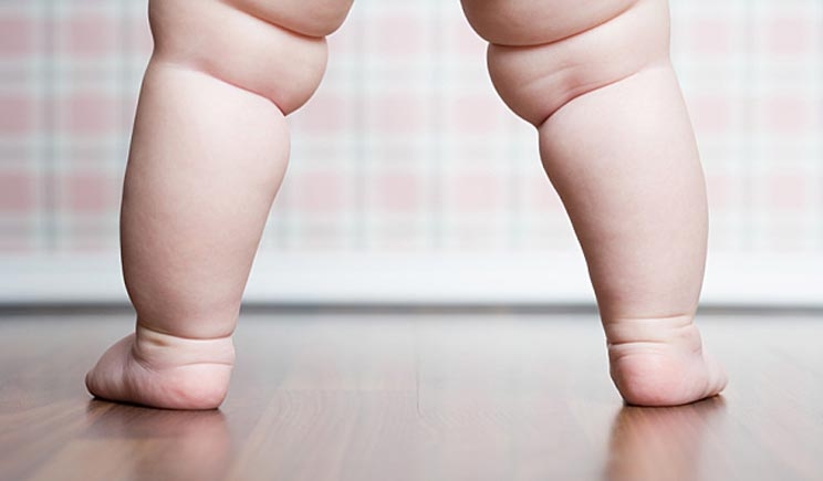 Bambina di tre anni arriva a pesare 35 chili per colpa del diabete