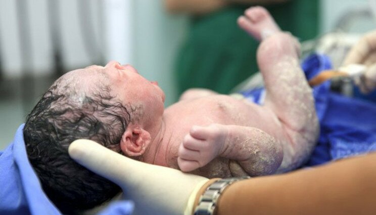 I bambini nati col parto cesareo sono più a rischio obesità