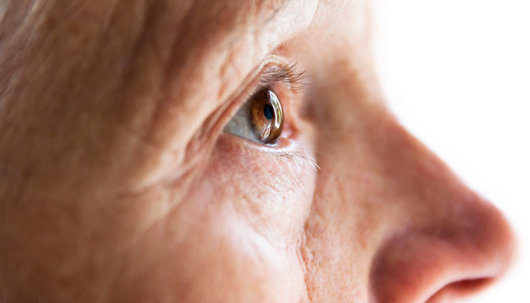 Alzheimer, diagnosi precoce dal test dell’olfatto