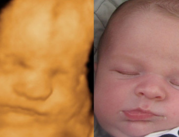 Screening del feto in 3D grazie alla realtÃ  virtuale
