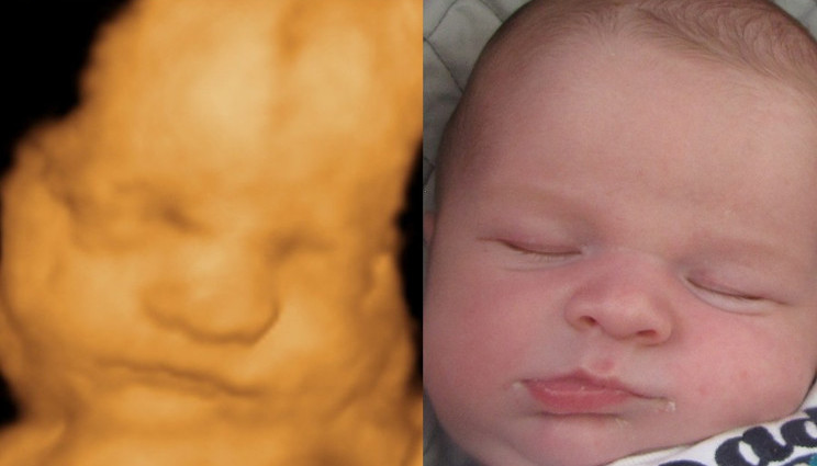 Screening del feto in 3D grazie alla realtÃ  virtuale