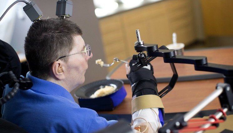 Tetraplegico muove gli arti grazie ad una serie di elettrodi